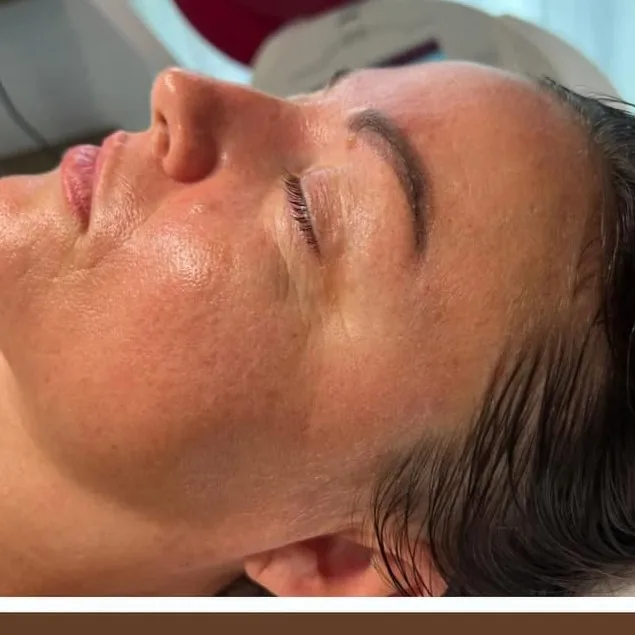Anti-aging programa po - jauninanti procedūra Palangoje